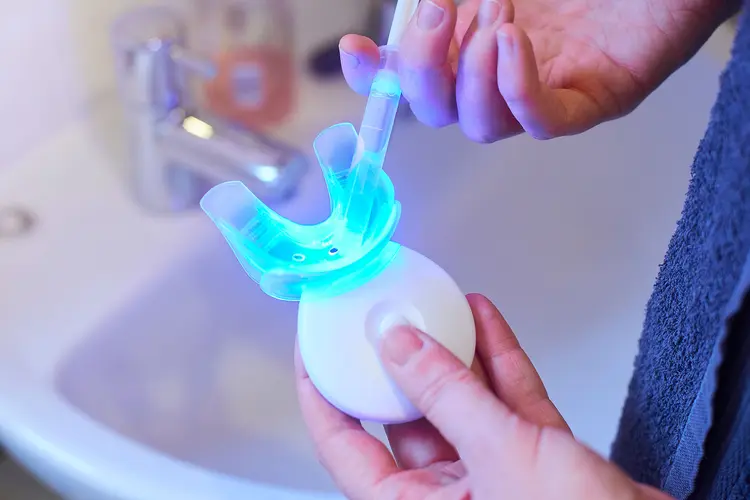 photo of teeth whitening