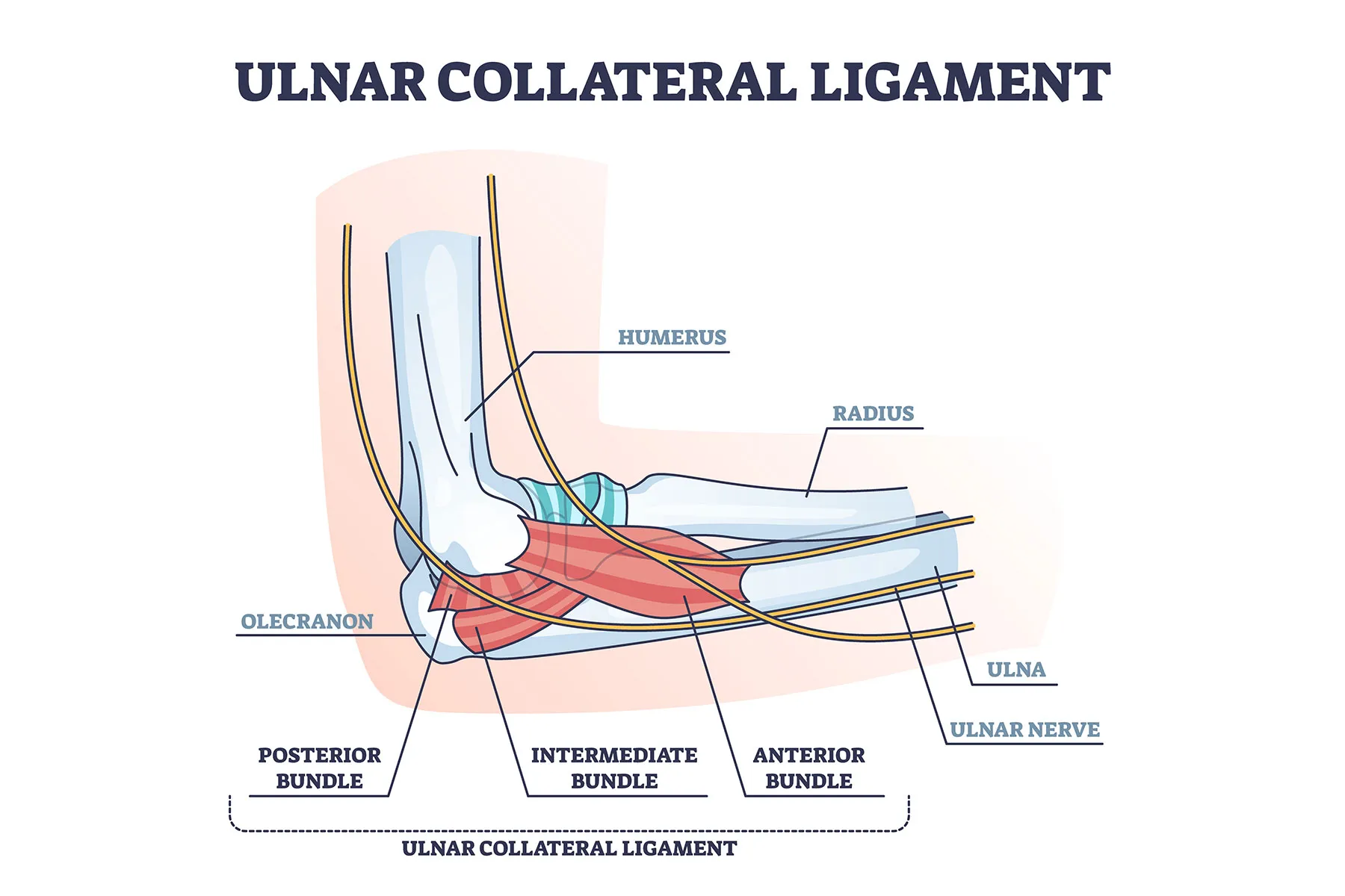 Tommy John Surgery: Overview, Procedure, Recovery \u0026 Treatment, image size:1800x1200