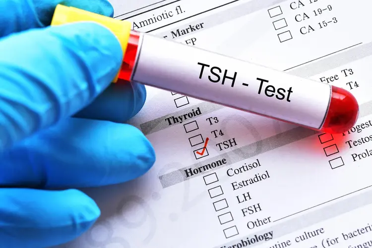 photo of thyroid stimulating hormone test