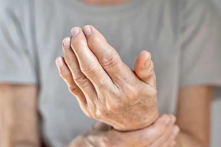 photo of hand with arthritis