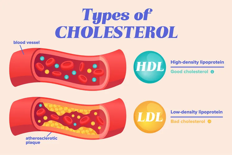 Healthy adults should have their cholesterol levels checked regularly with a blood test called a?lipid profile, which includes:  total, LDL (low-density lipoprotein), and HDL (high-density lipoprotein) cholesterol levels and triglyceride levels. Knowing these numbers can help you understand your risk of heart disease and stroke.    