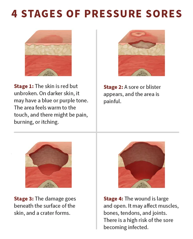 Types Of Skin Wounds