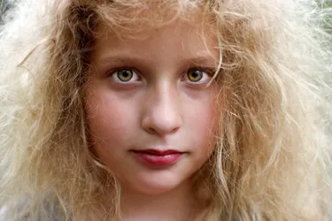 Uncombable hair syndrome is a rare condition that can cause dry, frizzy hair that you can’t comb flat. It happens before age 3 but may show up as late as age 12. The condition usually goes away in childhood.  (Photo credit: Photodisc/Getty Images)