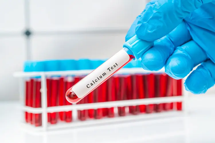 photo of Calcium blood test