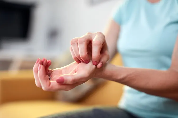 photo of woman scratching the palm of her hand