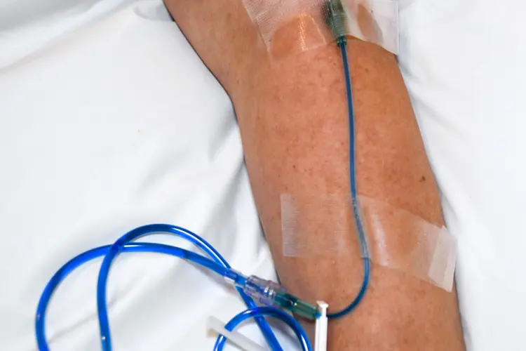 fotografie infuze methylenové modři