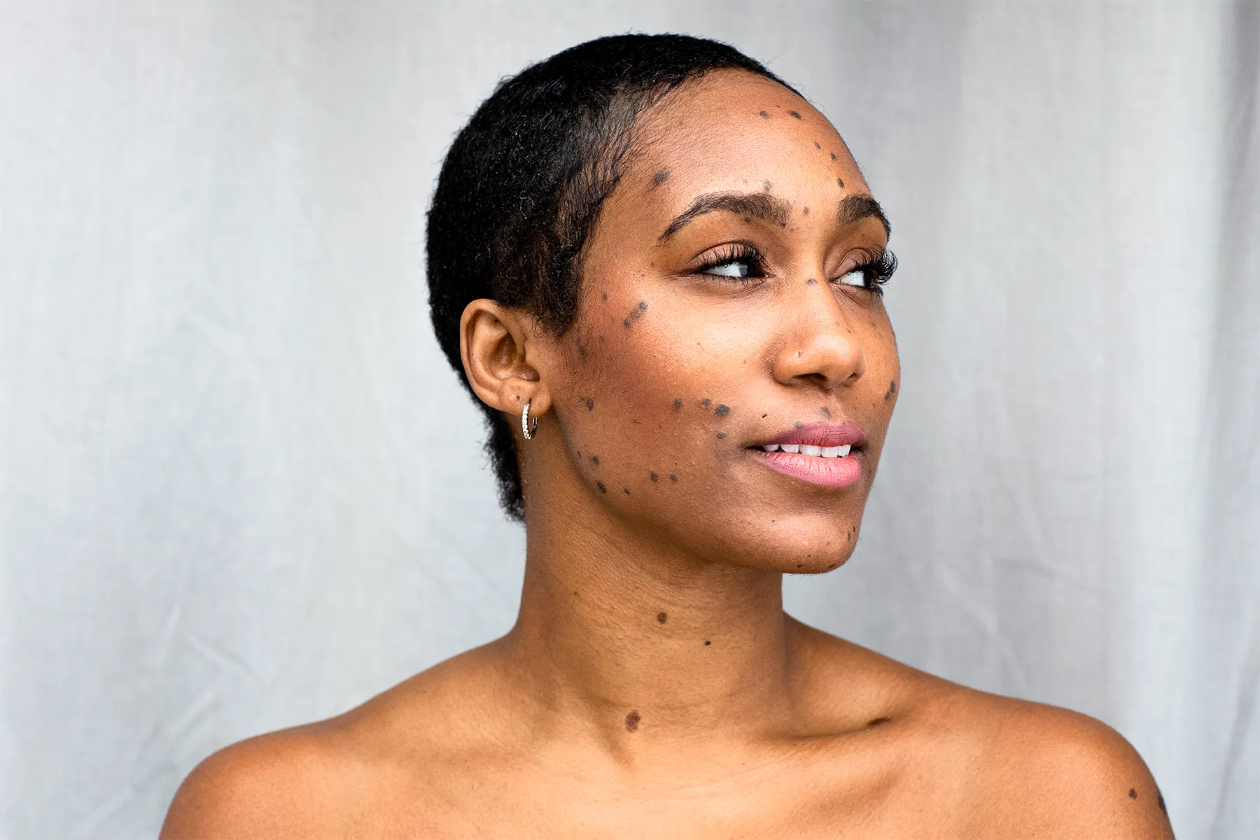 DPN: Causes, Symptoms, Diagnosis, and Treatment, image size:1800x1200