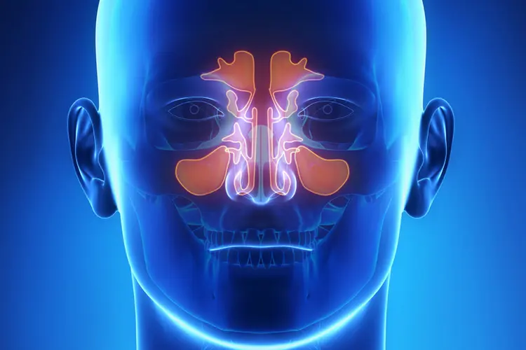photo of sinus infection