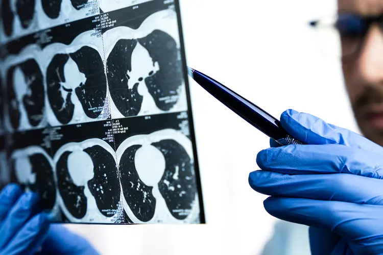 photo of doctor examines a CT scan