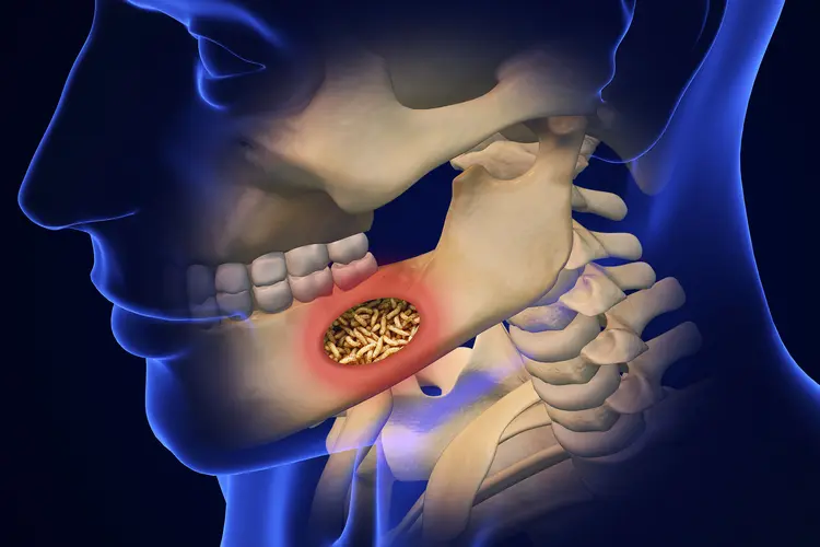 Mouth Larvae: Traits, Health Risks, and Why You Get Them