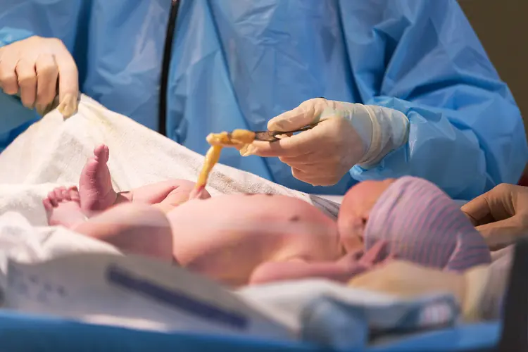photo of cutting of umbilical cord 