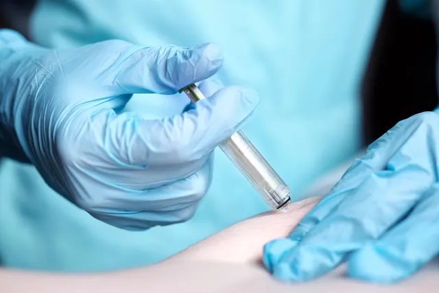 Tratamientos médicos para frenar el avance de la osteoporosis