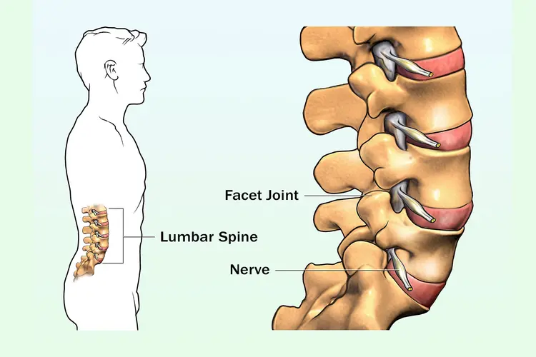 picture of facet joint in lumbar spine where facet joint arthritis can happen