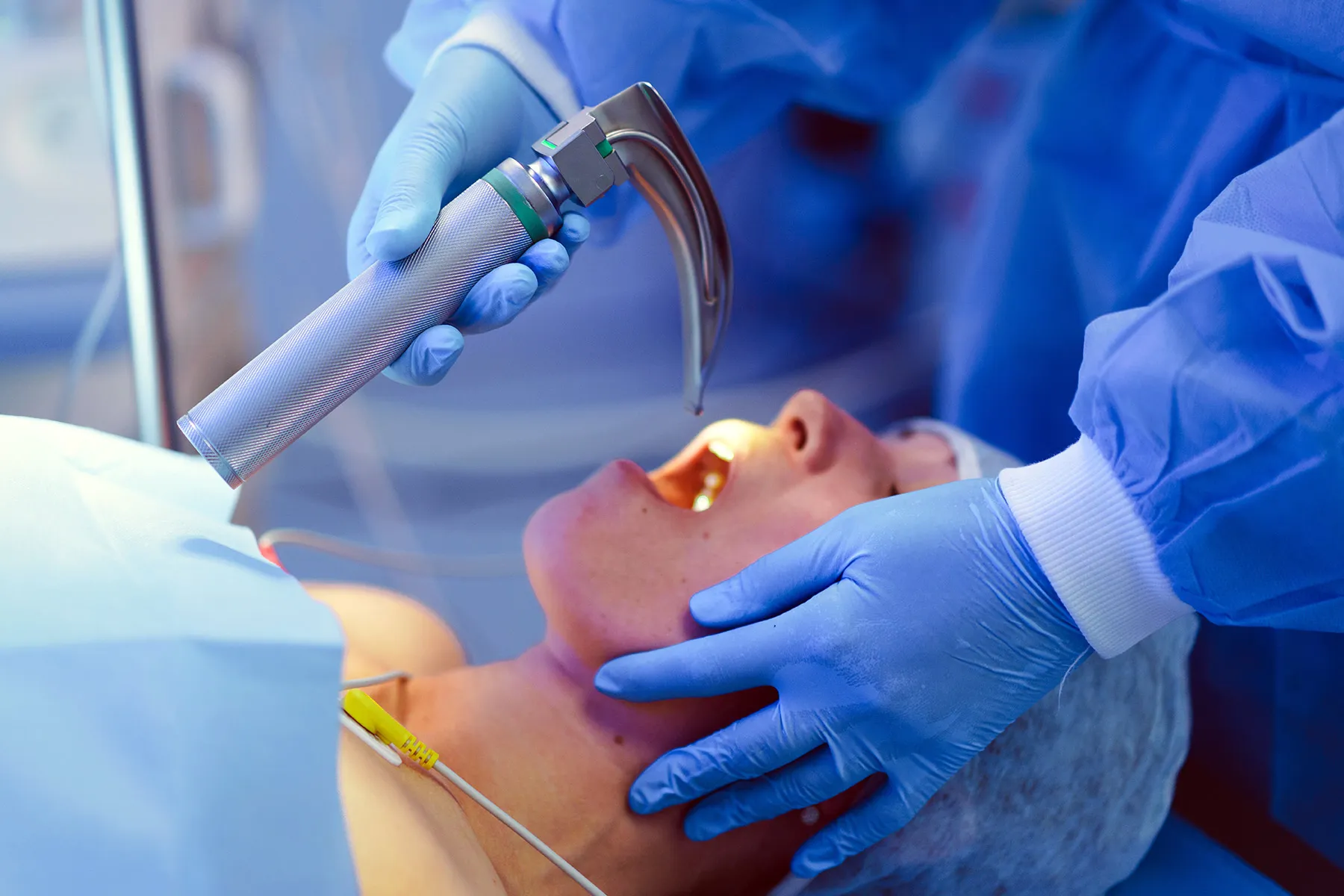 photo of patient being intubated