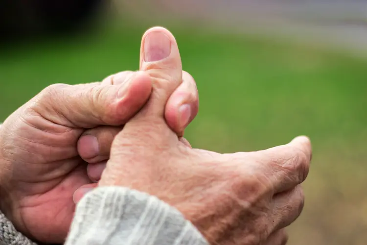 photo of senior man holding arthritic thumb; Thumb Arthritis (Basal Joint) 