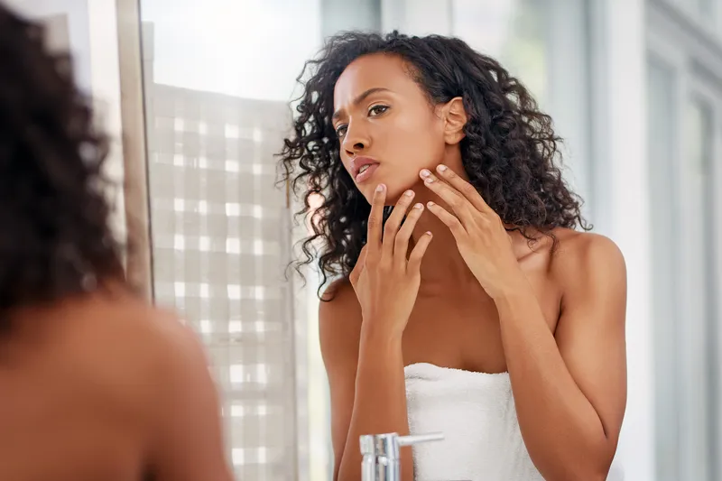 How Does Eczema Affect My Acne?