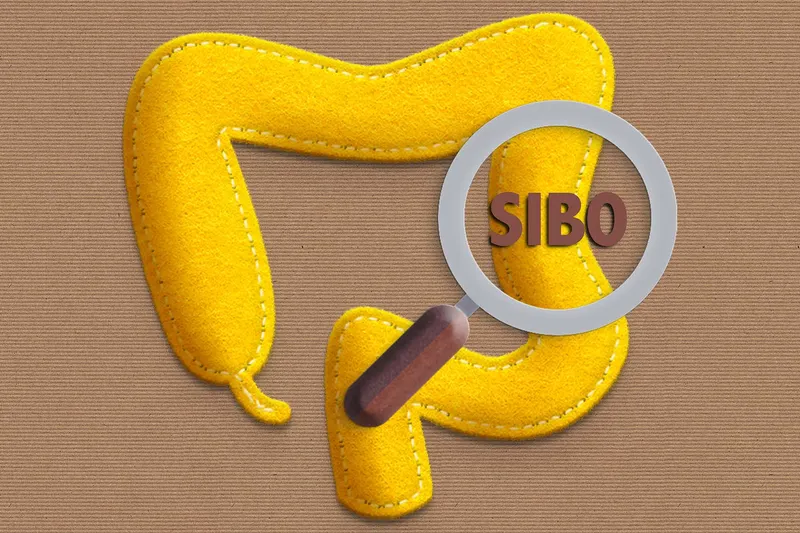 What Is SIBO? 