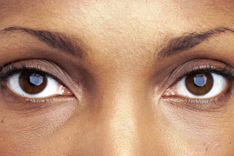 How Your Race Affects Your Eye Health