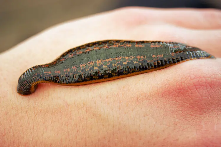 photo of leech sucking blood on hand