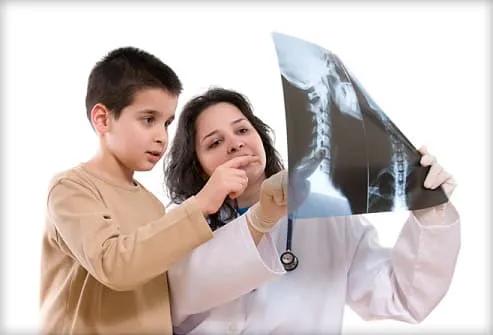 x ray for kids chest