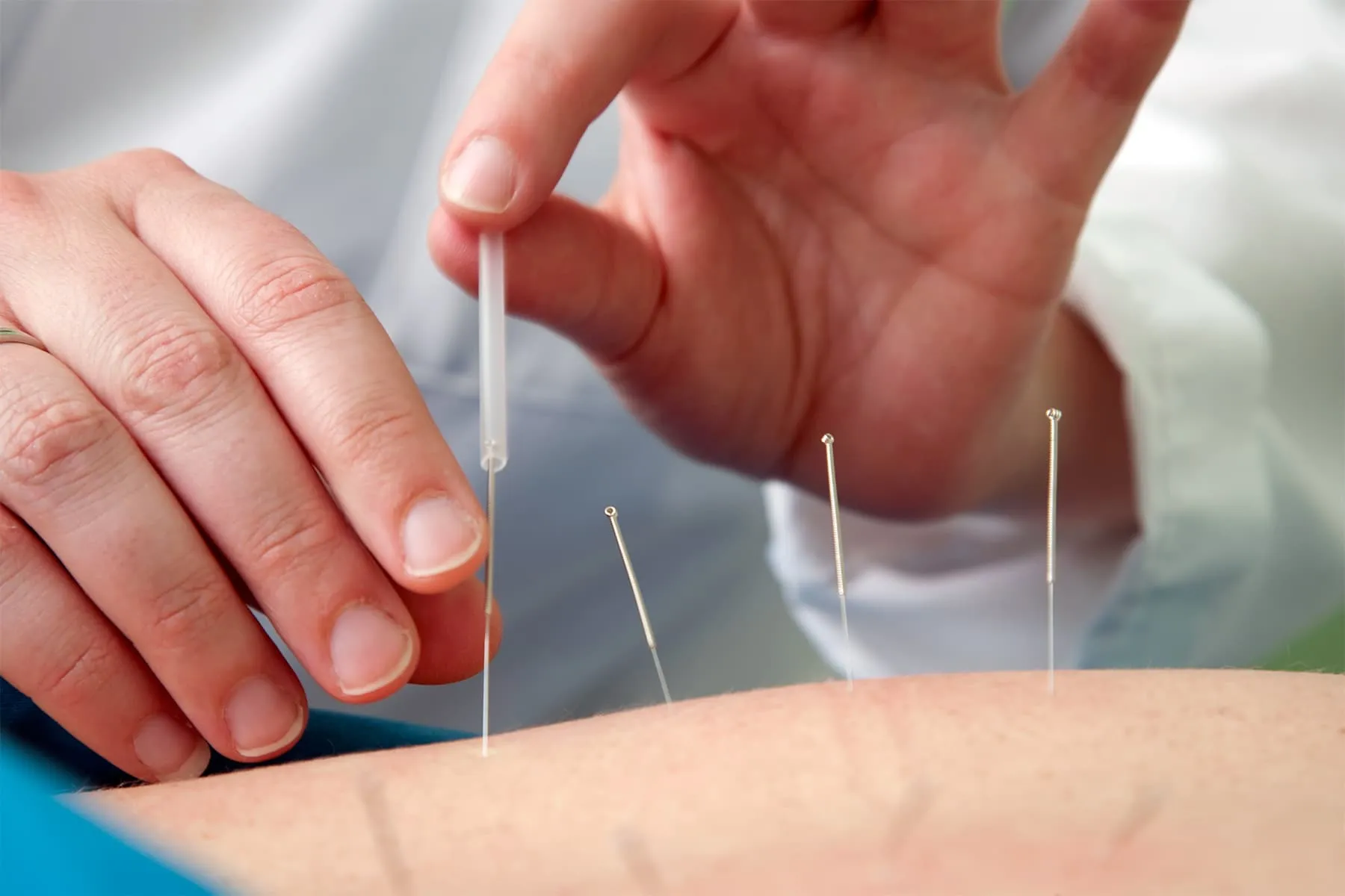 Other Therapies to Try