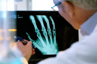 photo of x-ray