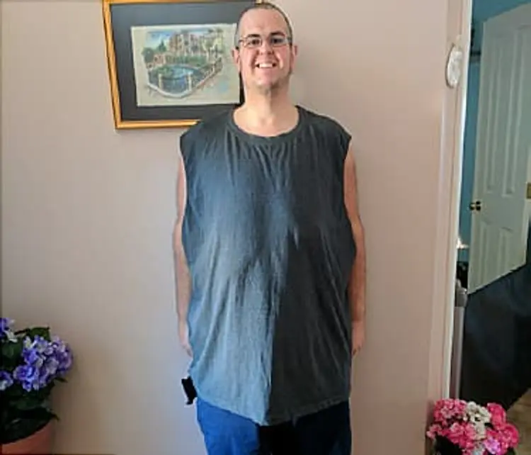 after weight loss