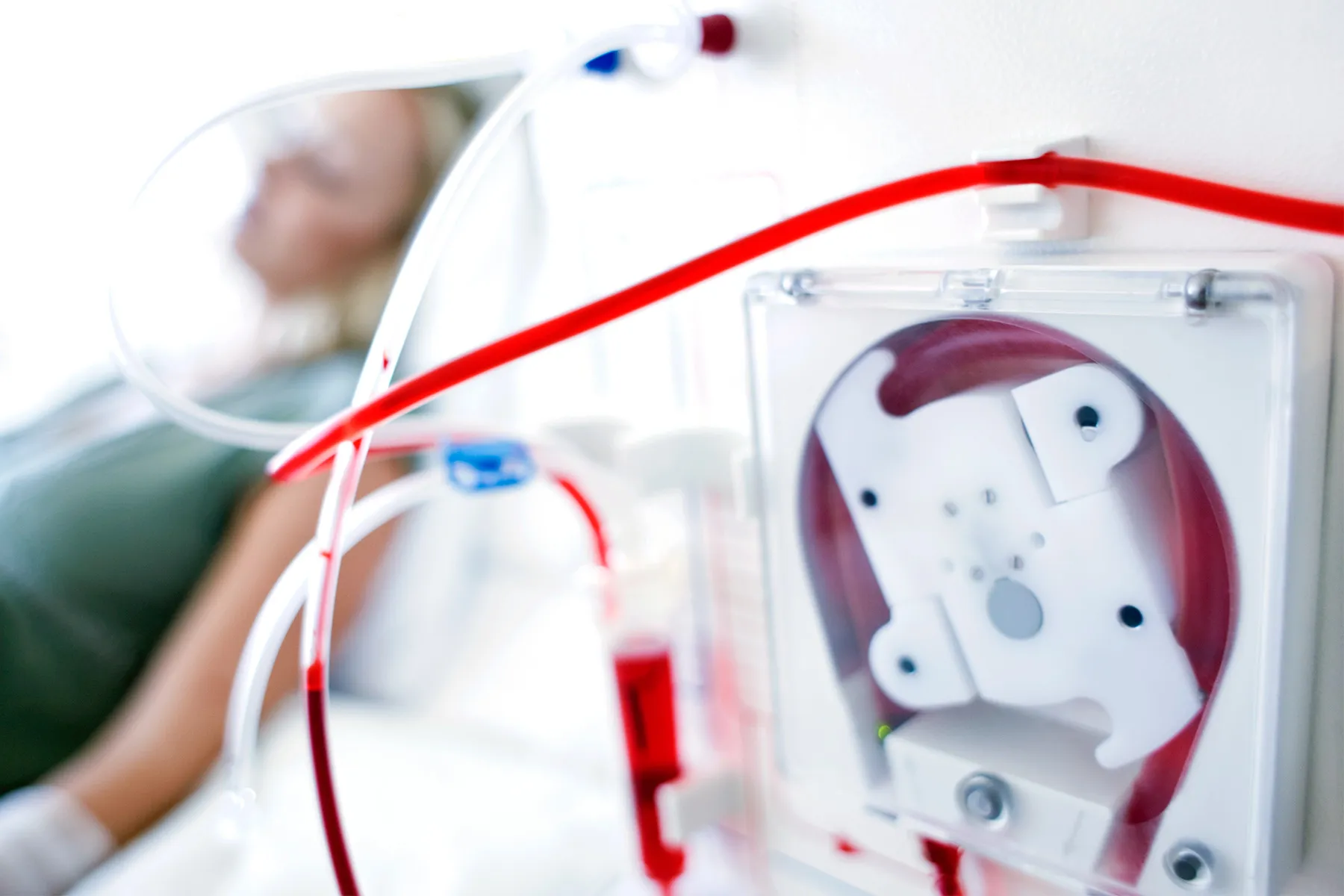 photo of woman receiving dialysis treatment