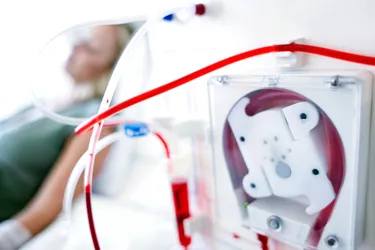 If your kidney disease becomes very severe and crosses a point where there's not enough function to maintain your body, you may need dialysis. (Photo credit: Science Photo Library / Getty Images)