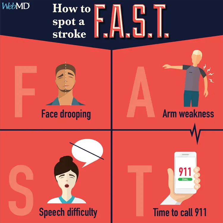 infographic on how to spot a stroke