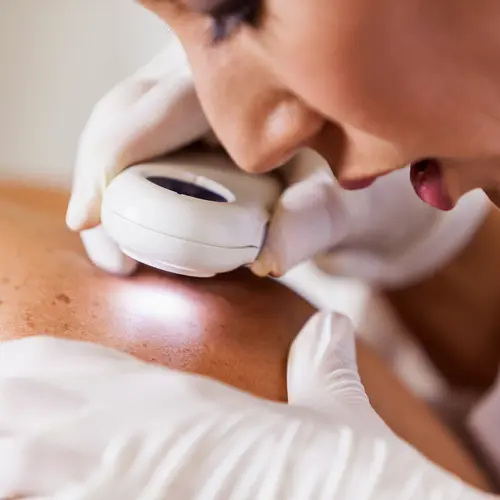 photo of dermatologist looking at skin