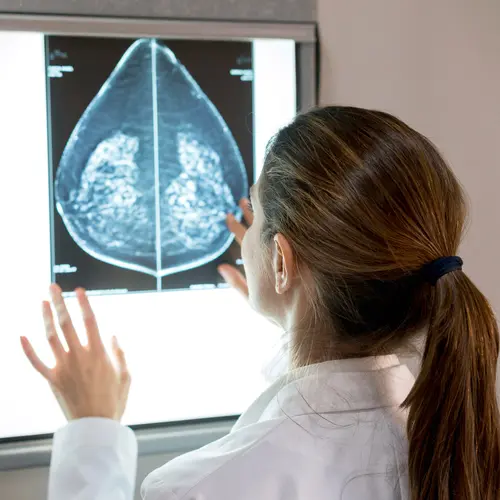 photo of doctor examining mammogram 