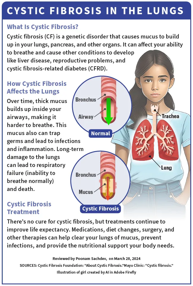 infographic on cystic fibrosis in the lungs