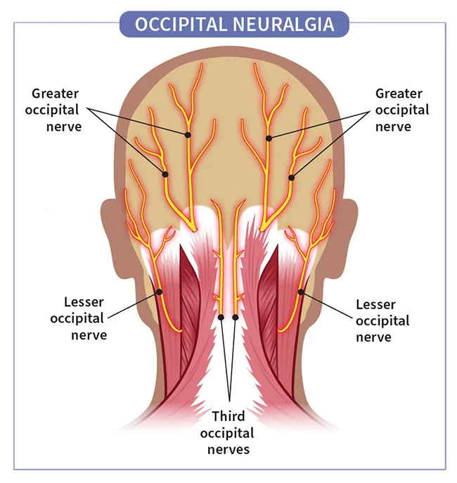 Back Of Neck Anatomy Nerves