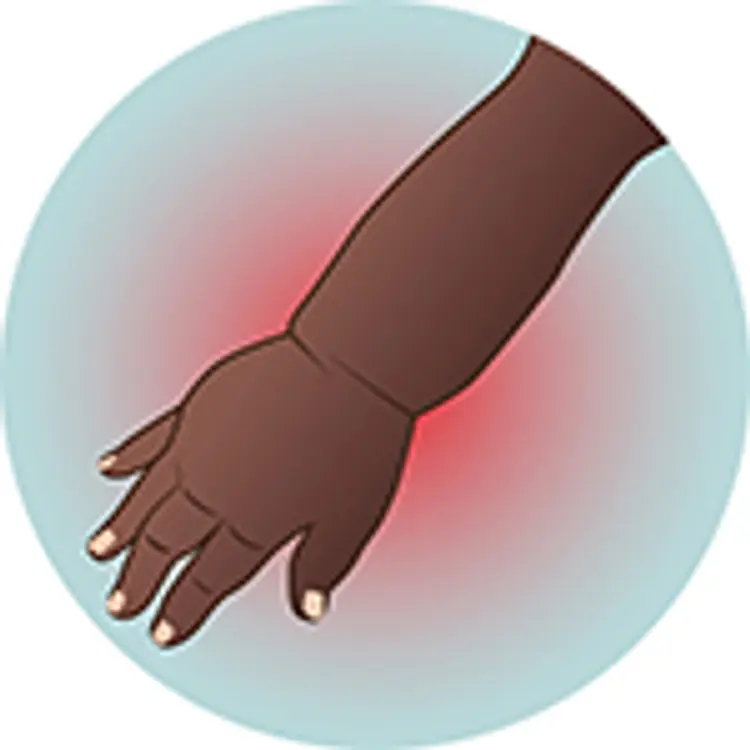 illustration of swelling