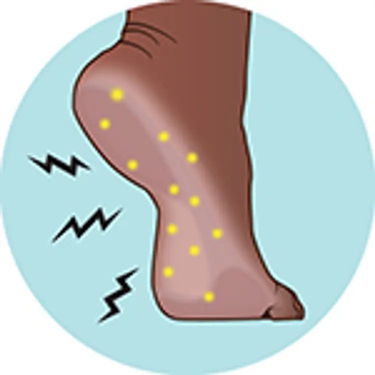 illustration of tingling