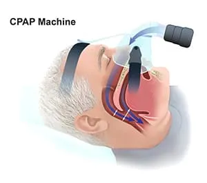 illustration of senior man wearing cpap