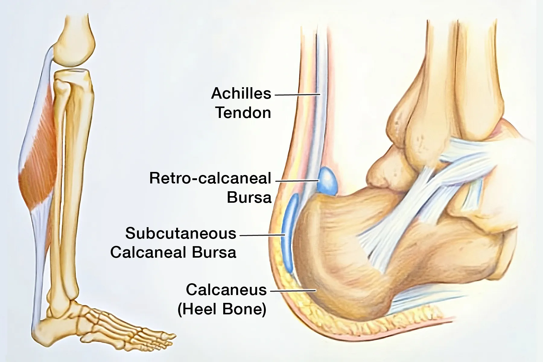 photo of Achilles tendon