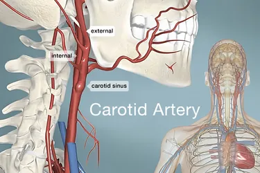 The carotid arteries are major blood vessels in the neck that supply blood to the brain, neck, and face. There are two carotid arteries, one on the right and one on the left.  Photo Credit: WebMD 