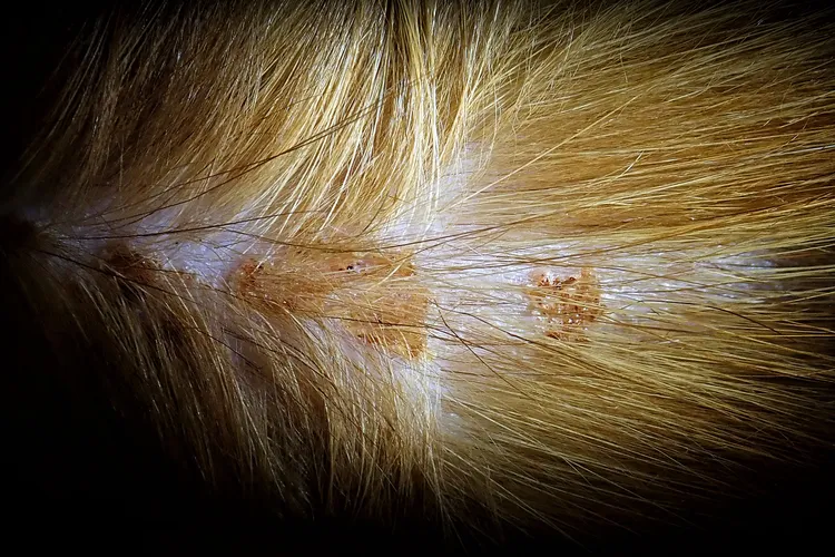 photo of Scabs on the skin of a cat.