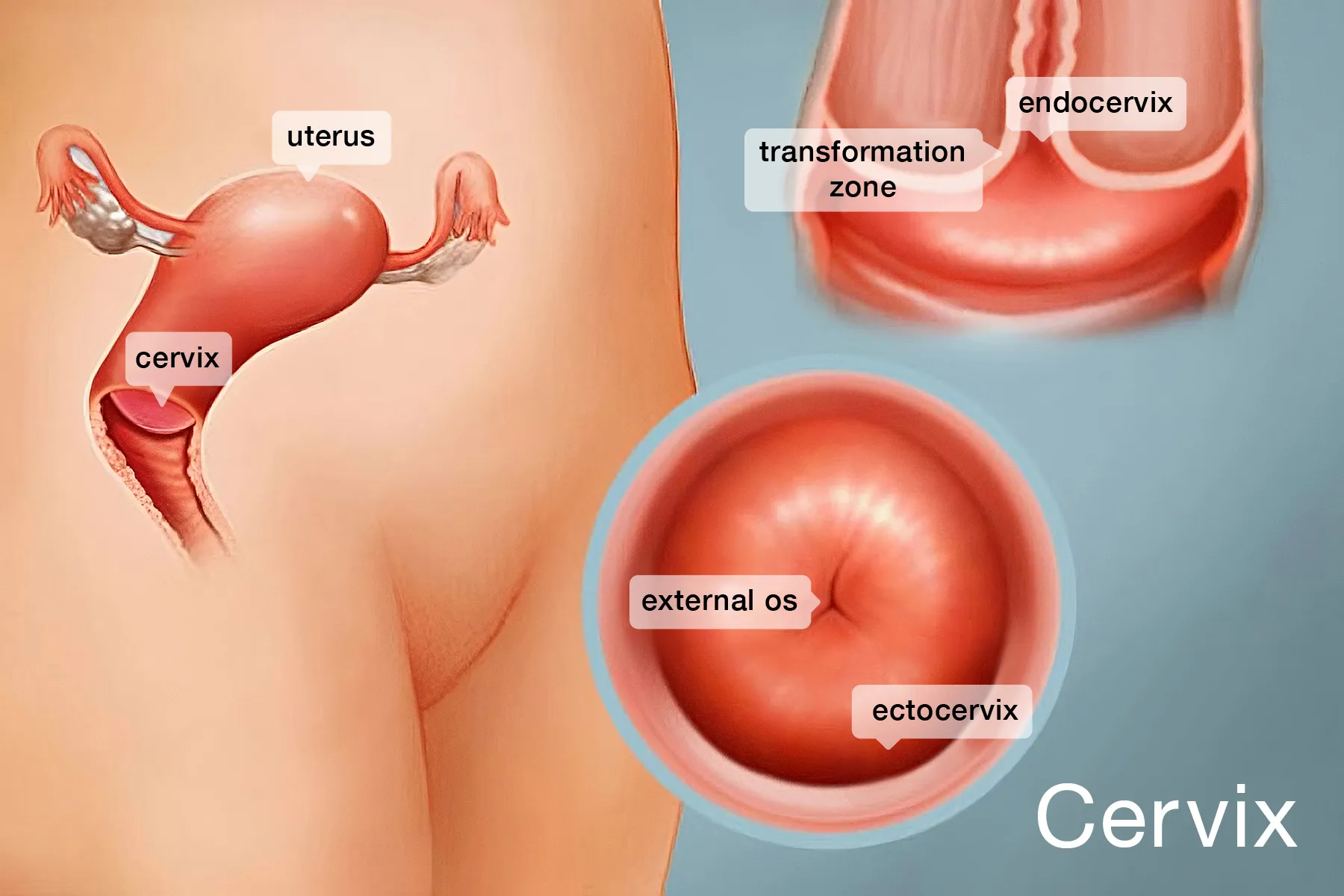 cervix Cervical Cryotherapy: Procedure and Side Effects