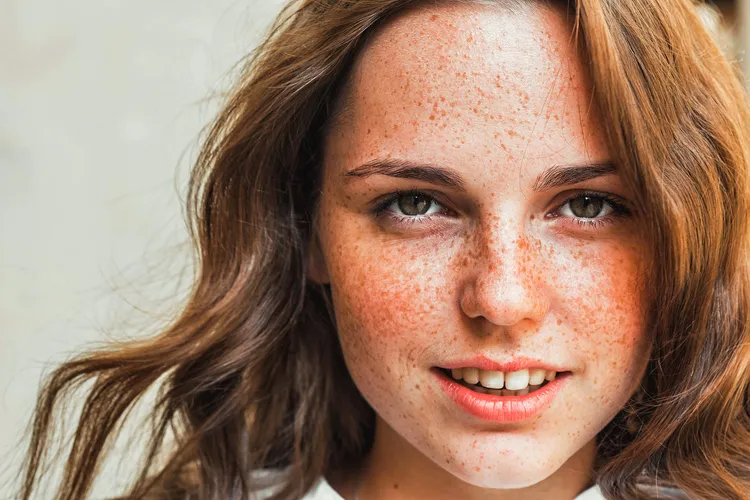 photo of Young woman with freckles.