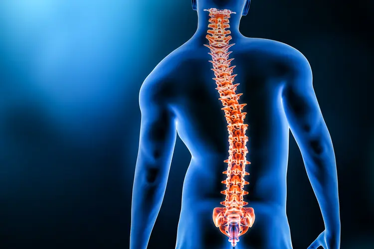 photo of scoliosis