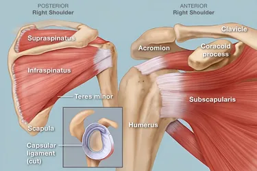 Shoulder pain has many causes.