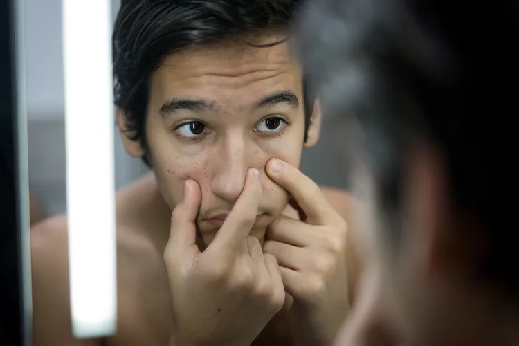 photo of teen with acne looking in mirror