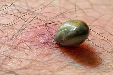 Tick bites don't always cause disease, but when they do, it can be serious. Photo: Moment/Getty Images