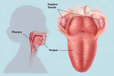 Your tonsils act as filters, trapping germs that could otherwise enter your airways and cause infection. They also make antibodies to fight infection. (Photo credit: WebMD)
