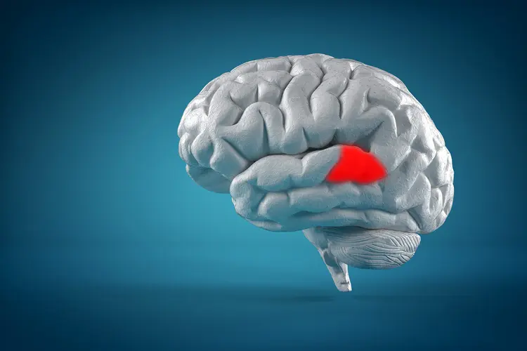 photo of Wernicke’s Aphasia