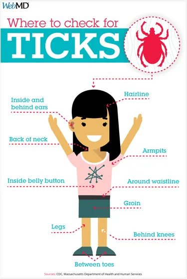 Where to look for ticks