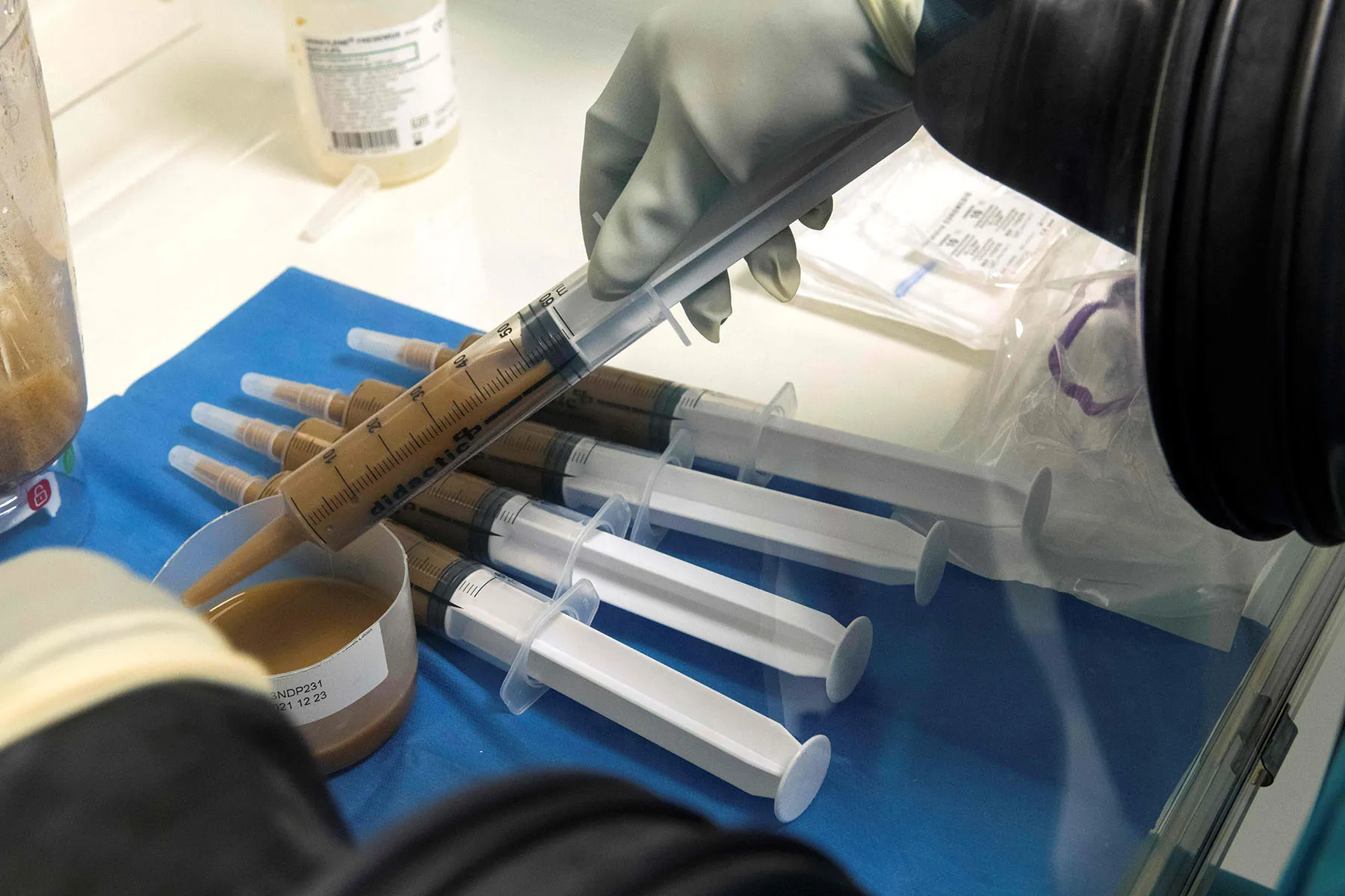 Fecal Transplant: Reasons You May Need One